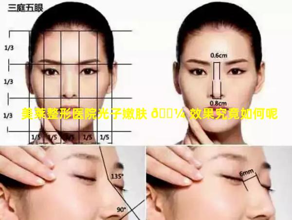 美莱整形医院光子嫩肤 🌼 效果究竟如何呢